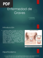 Enfermedad de Graves Terminado