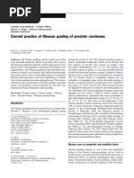 Current Practice of Gleason Grading of Prostate Carcinoma: Reviewarticle