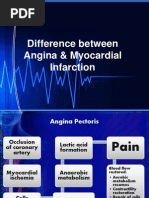 Difference Between Angina & Myocardial Infarction