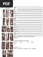 Date Side: A Curve Lat Border B Medial Crease C Talar Head