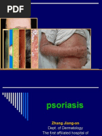 Psoriasis