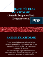 Anemia Falciforme