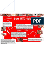 Eye Injuries - Poster