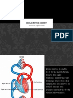 Ventricular Septal Defect Presentation