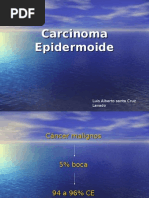 Carcinoma Epidermoide