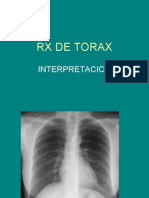 Interpretación de Radiografías Toracicas