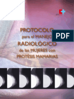 Protocolo Manejo Radiologico Protesis Mamarias