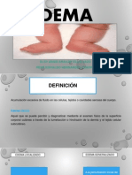 Edema 2