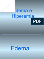 Edema e Hiperemia