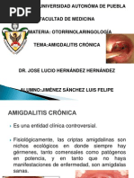 Amigdalitis Crónica