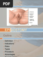 Episiotomy