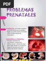 Problemas Prenatales