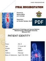 Mitral Regurgitation