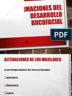 Malformaciones Del Desarrollo Bucofacial