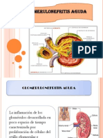 Glomerulonefritis Aguda-Corregido