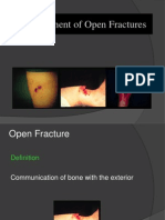 Open Fractures