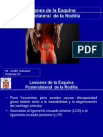 Esquina Posterolateral 1