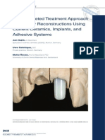 Anterior Implant