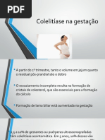 Colelitíase Na Gestação