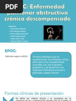 EPOC