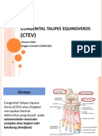 Congenital Talipes Equinoveros (CTEV)