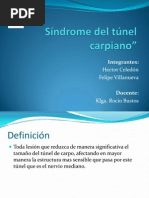 Síndrome Del Túnel Carpiano