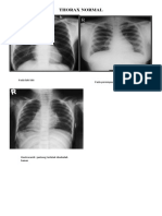 Rangkuman Radiologi