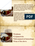 MCQ Ophthalmology