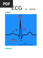 ECG Made Easy by Mallareddy Sripuja