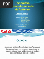 Exame de Litiase Renal Atraves Da Tomografia