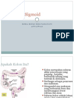 Referat CA Kolon Sigmoid