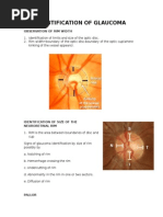 Identification of Glaucoma: Observation of Rim Width