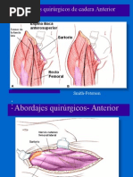 Abordajes Quirurgicos de Cadera