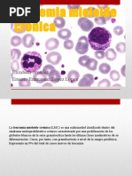 Leucemia Mieloide Crónica