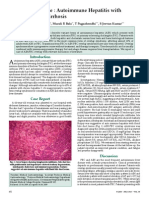 Overlap Syndrome: Autoimmune Hepatitis With Primary Biliary Cirrhosis