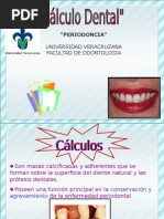 Calculo Dental