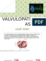 VALVULOPATIAS