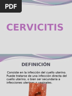 CERVICITIS