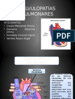 Valvulopatias Pulmonares