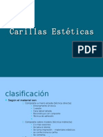 Carillas Esteticas