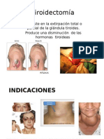 Tiroidectomía