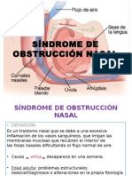 Síndrome de Obstrucción Nasal