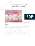 Restauraciones Dentales Con Cementos de Ionómero de Vidrio