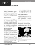 Division Pleural