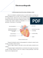 Ekg