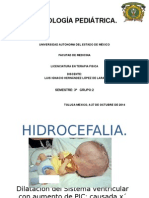 Hidrocefalia