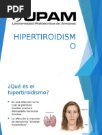 HIPERTIROIDISMO