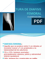 Fractura de Diafisis Femoral