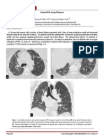 Interstitial Lung Disease