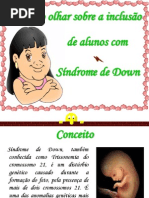 Sindrome de Downn